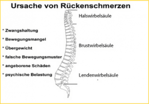 Ursache von Rückenschmerzen